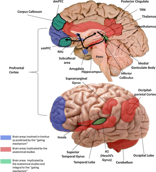 Study Links Tinnitus to Cognitive Impairment: New Insights Revealed