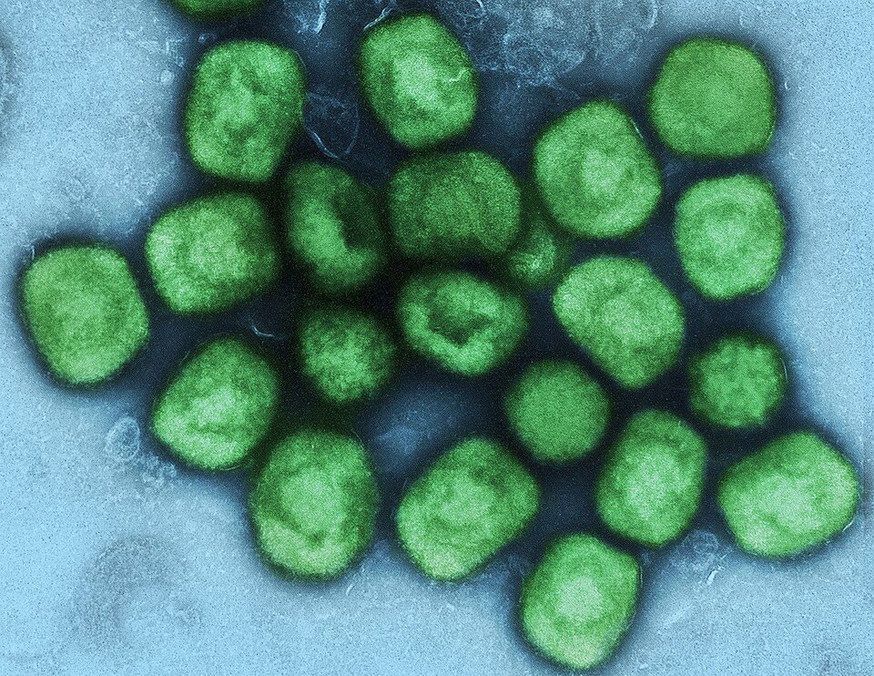 Mpox Surge in Sierra Leone: Understanding the West African Health Crisis