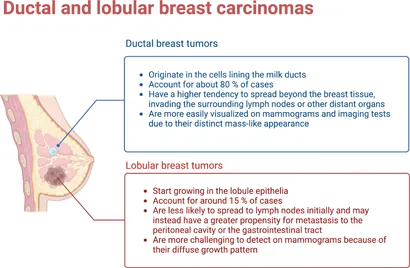 Horsham Doctor Advocates for Increased Research on Lobular Breast Cancer