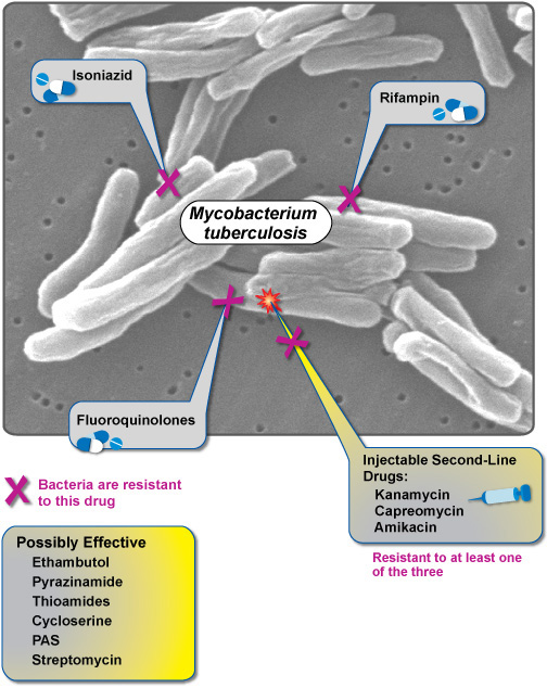 Optimizing Antibiotic Dosing in Tuberculosis: Effects on the Respiratory Microbiome