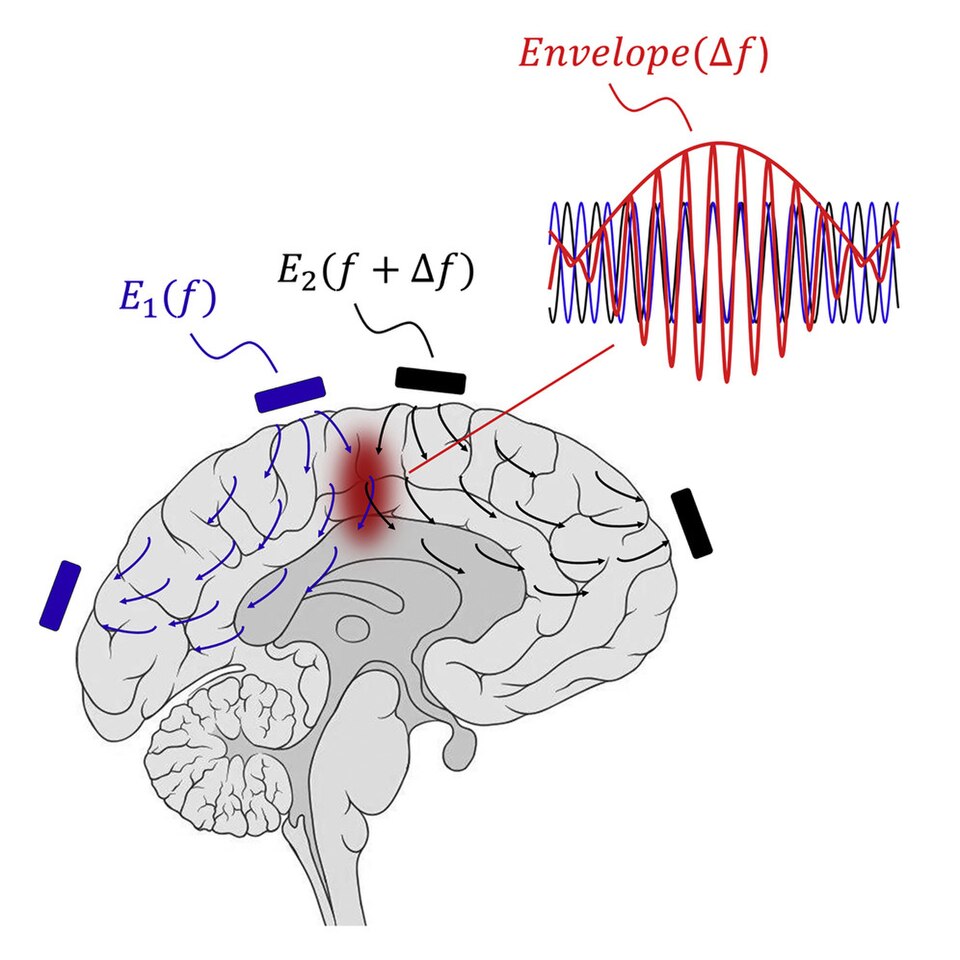 New Imaging Benchmark Enhances Alzheimer's Detection in Diverse Groups