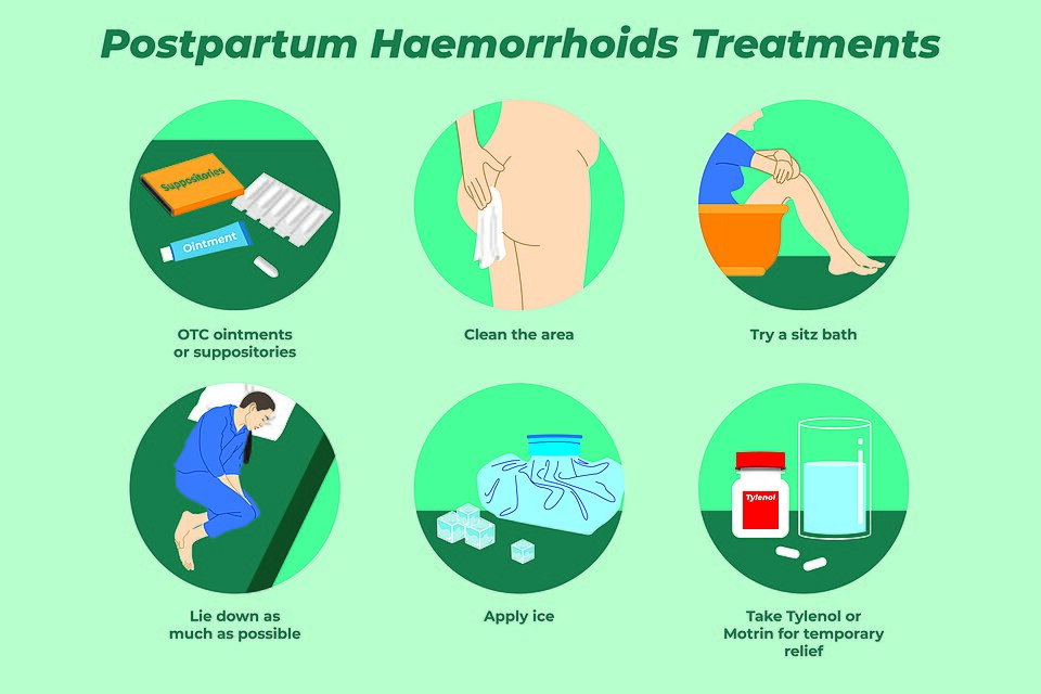 Understanding Haemorrhoids: Causes, Symptoms, and Effective Treatments