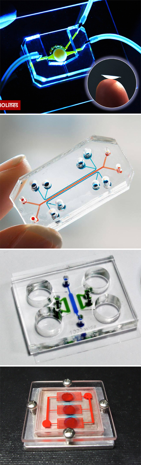 Advancements in Organ Chip Technology Enhance Chemotherapy Predictions for Esophageal Adenocarcinoma