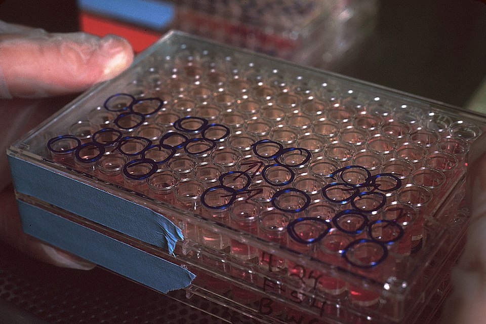 Invivyd's Monoclonal Antibody Demonstrates 84% Risk Reduction in COVID-19