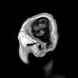 Exploring Viral Links to Neurodegeneration in Primate Models