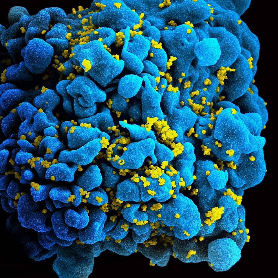 Breakthrough in Antiviral Research: New Molecules Target HIV Effectively