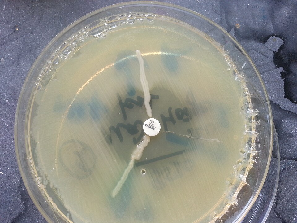 Harnessing Gut Microbial Competition to Combat Drug-Resistant E. coli