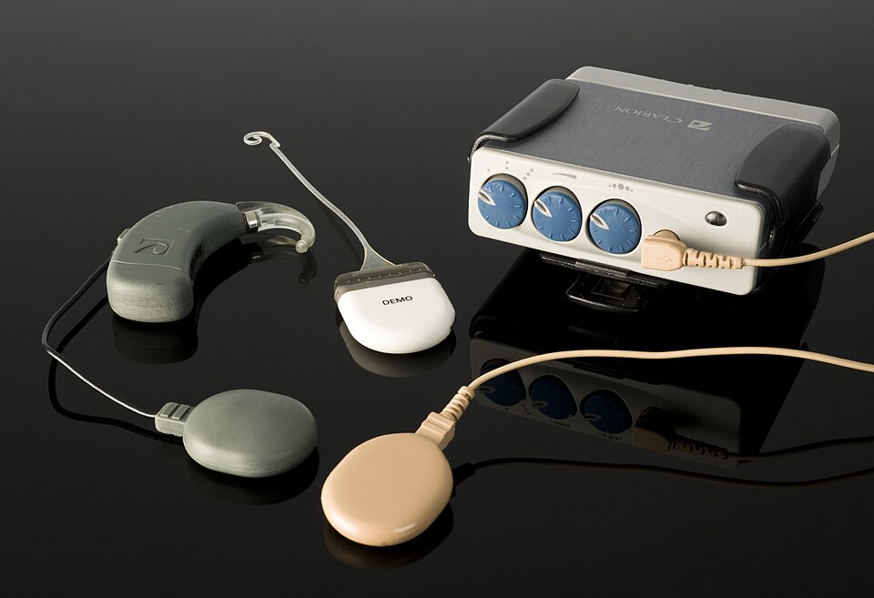 Cochlear Launches Innovative Hearing Implant in China’s Medical Tourism Zone