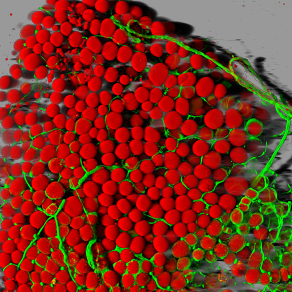Impact of Weight Loss on Fat Cell Health and Earth's Rotational Changes