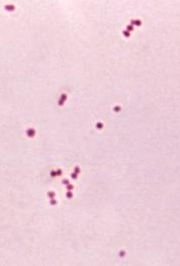 Australia Faces Peak Meningococcal Disease Season: Urgent Warnings Issued