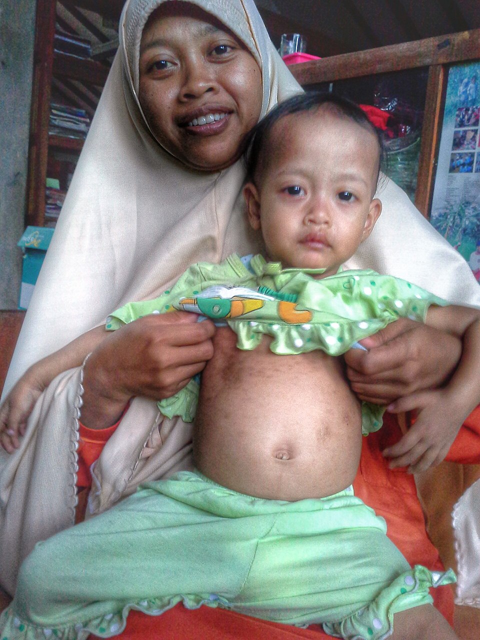 South Asia Achieves Record Child Immunization Rates, Led by India and Nepal
