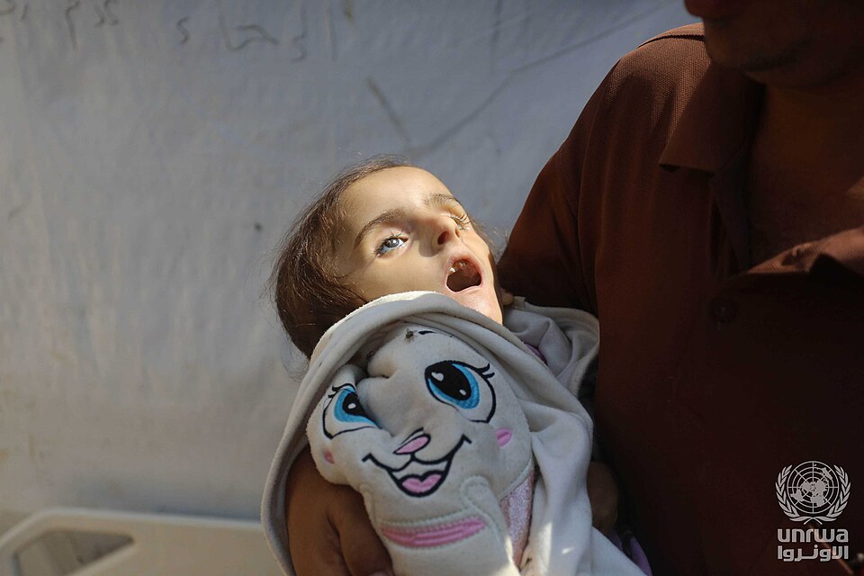 UNRWA Reports Alarming Malnutrition Rates Among Gaza's Children