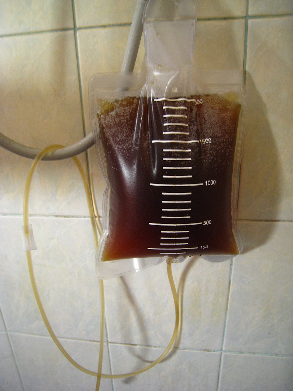 Experts Warn Against Risks of 'Coffee Enemas' in Health Trends