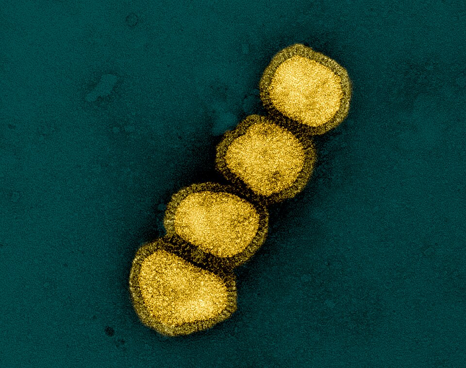 Kollam School Reports H1N1 Cases: Health Officials Respond