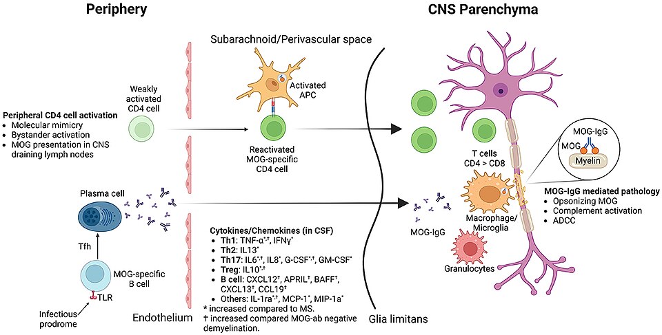 Meningitis: An Emerging Early Indicator of MOGAD in Patients