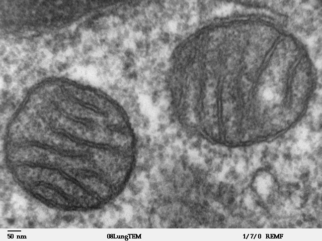 New Study Links Energy Overload in Brain Cells to Sleep Trigger
