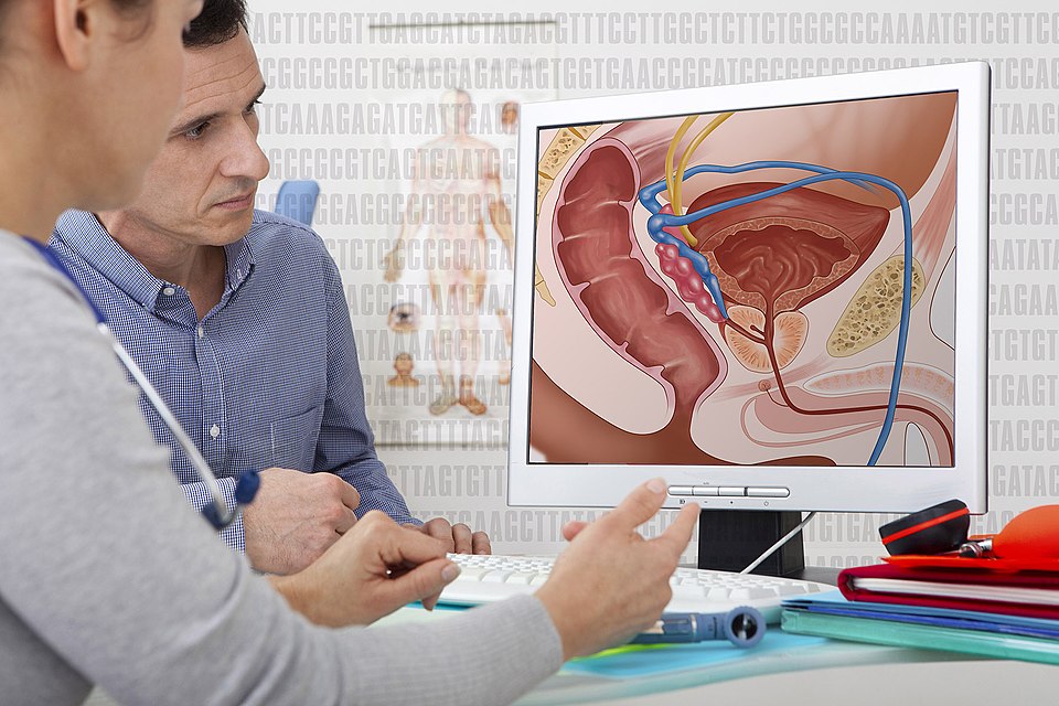 Addressing Treatment Gaps in mCRPC: The Need for Personalized Strategies