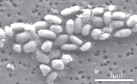 Retracted: The Controversial 2010 'Arsenic Life' Study's Legacy