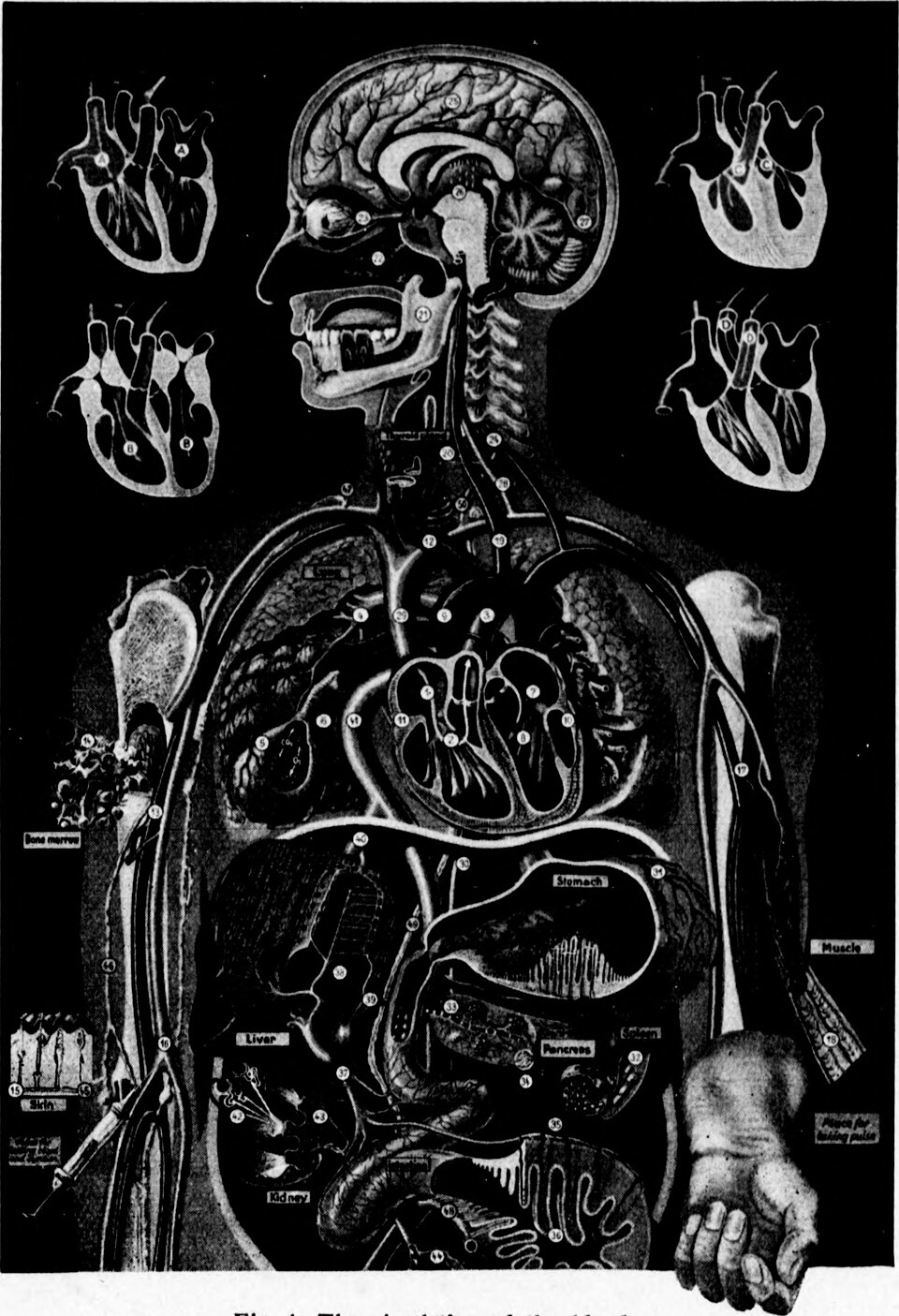 Understanding Coronary Calcium Scans: A Vital Heart Health Assessment
