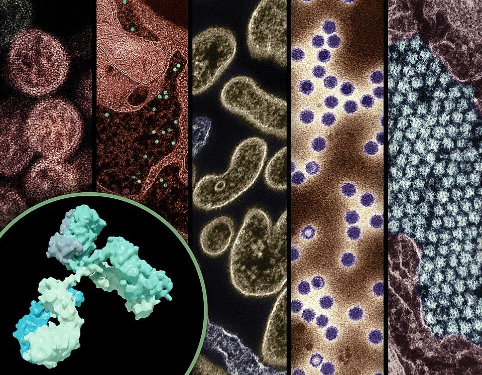 Breakthrough Nipah Vaccine for Pigs Aims to Safeguard Human Health