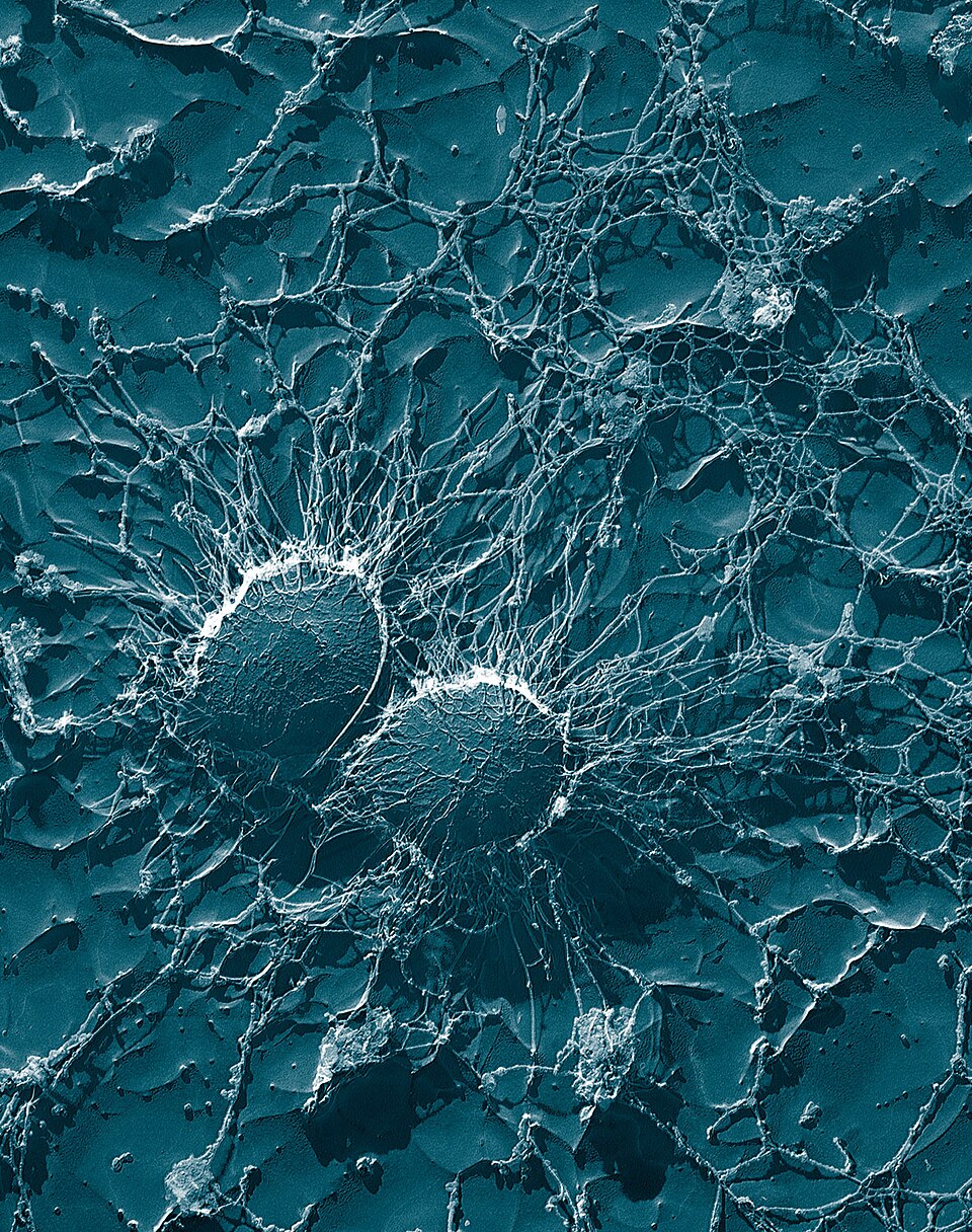 Real-Time Tracking of Superbugs: A New Approach to Combat Antibiotic Resistance