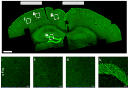 c-Fos: A Dual Role in Memory Formation and Alzheimer's Disease Dynamics
