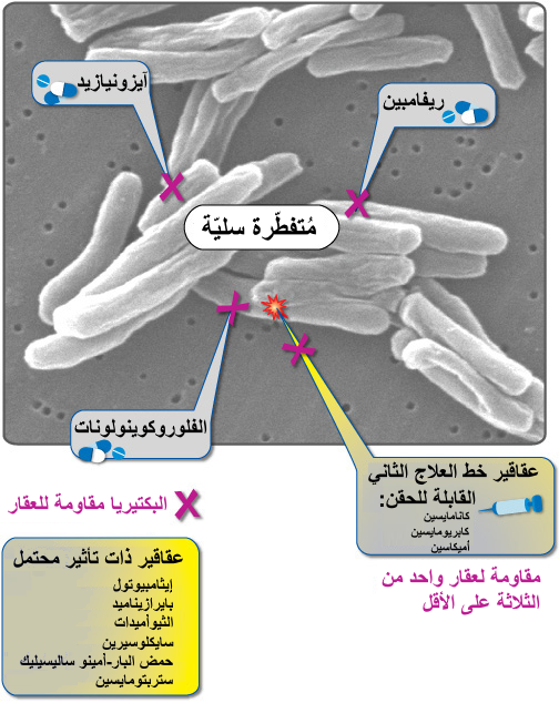 University of Otago Researchers Advance Understanding of Tuberculosis Drug Resistance