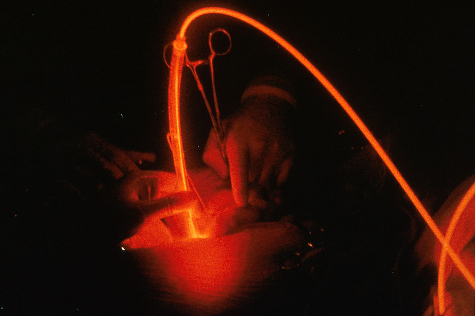 WSPOS 2025 Consensus Statement Endorses Red-Light Therapy for Myopia