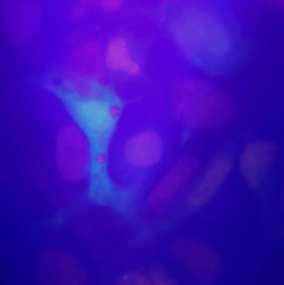 Novel Molecular Atlas Transforms Understanding of Human Kidney Function