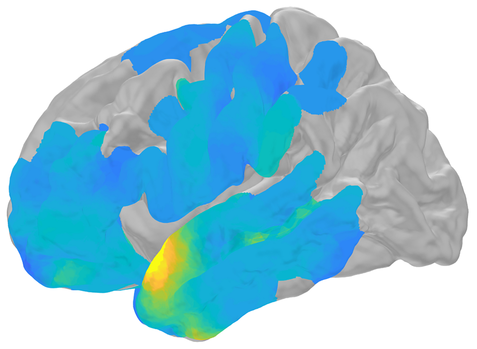 New Research Uncovers Brain's Mechanism for Active Memory Deletion